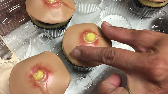 pimple-cupcakes-dr-pimple-popper-blessed-by-baking-2