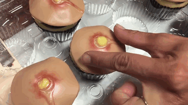 pimple-cupcakes-dr-pimple-popper-blessed-by-baking-3